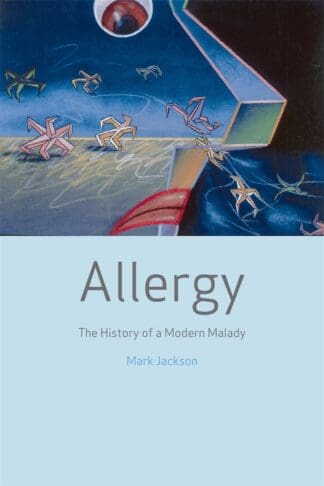 Allergy (Paperback)