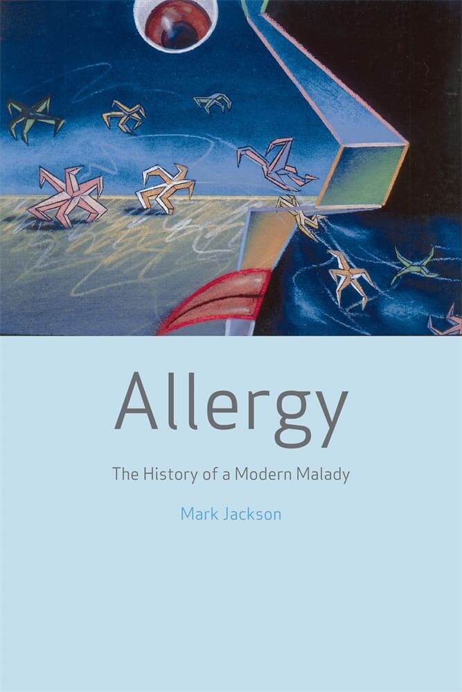 Allergy (Paperback)