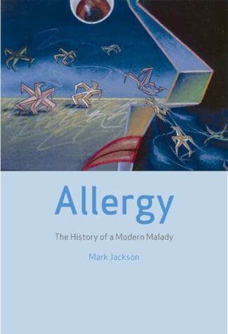 Allergy (Ebook)